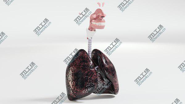 images/goods_img/20210312/3D Respiratory System Smoker's Lungs heavy stage/2.jpg